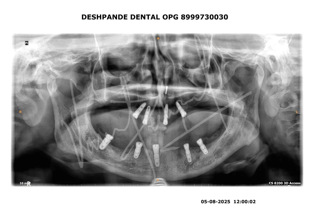 X-ray Image 3