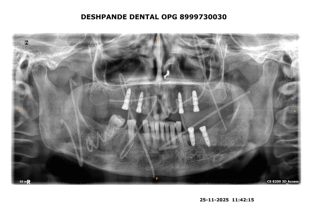 X-ray Image 5